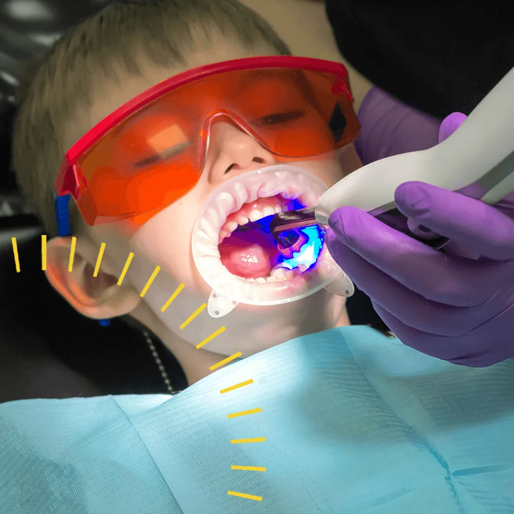 Laser Dentistry